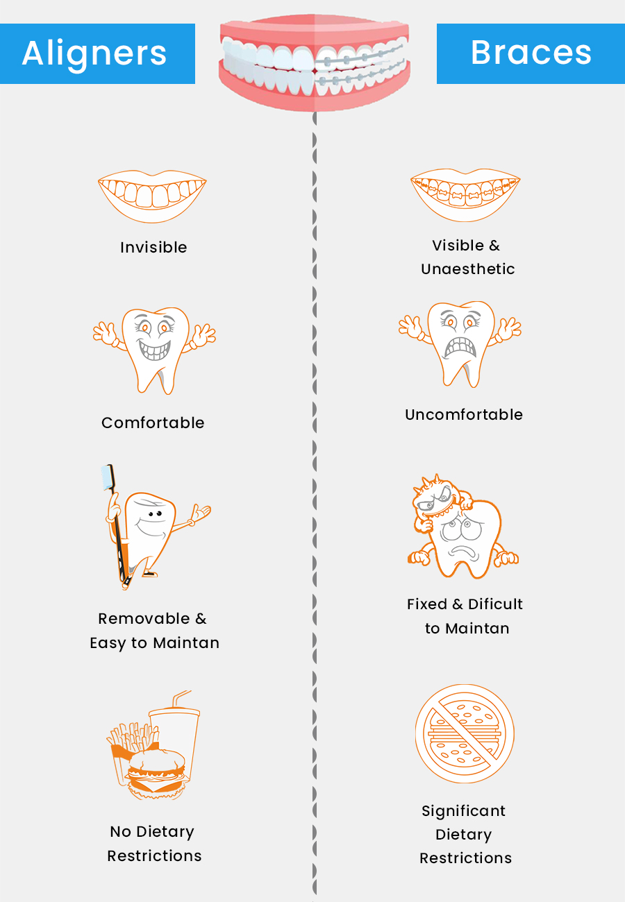 3D Aligner Vs Braces Digital Orthodontics Solutions